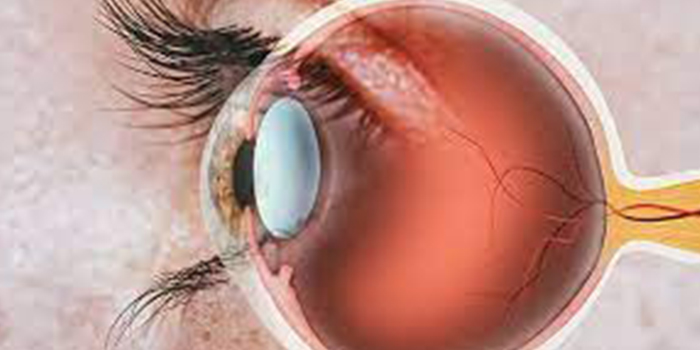 Arunodaya Eye Clinic provides best Retina Treatment in Wakad, Pune, its one of Pune's best retina clinic led by Dr. Anuprita Gandhi Bhatt, Opthamologist in Pune.